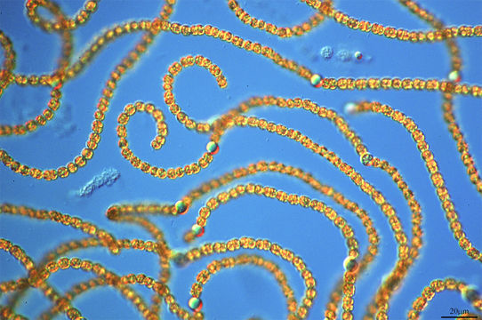 Image of <i>Anabaena flos-aquae</i>