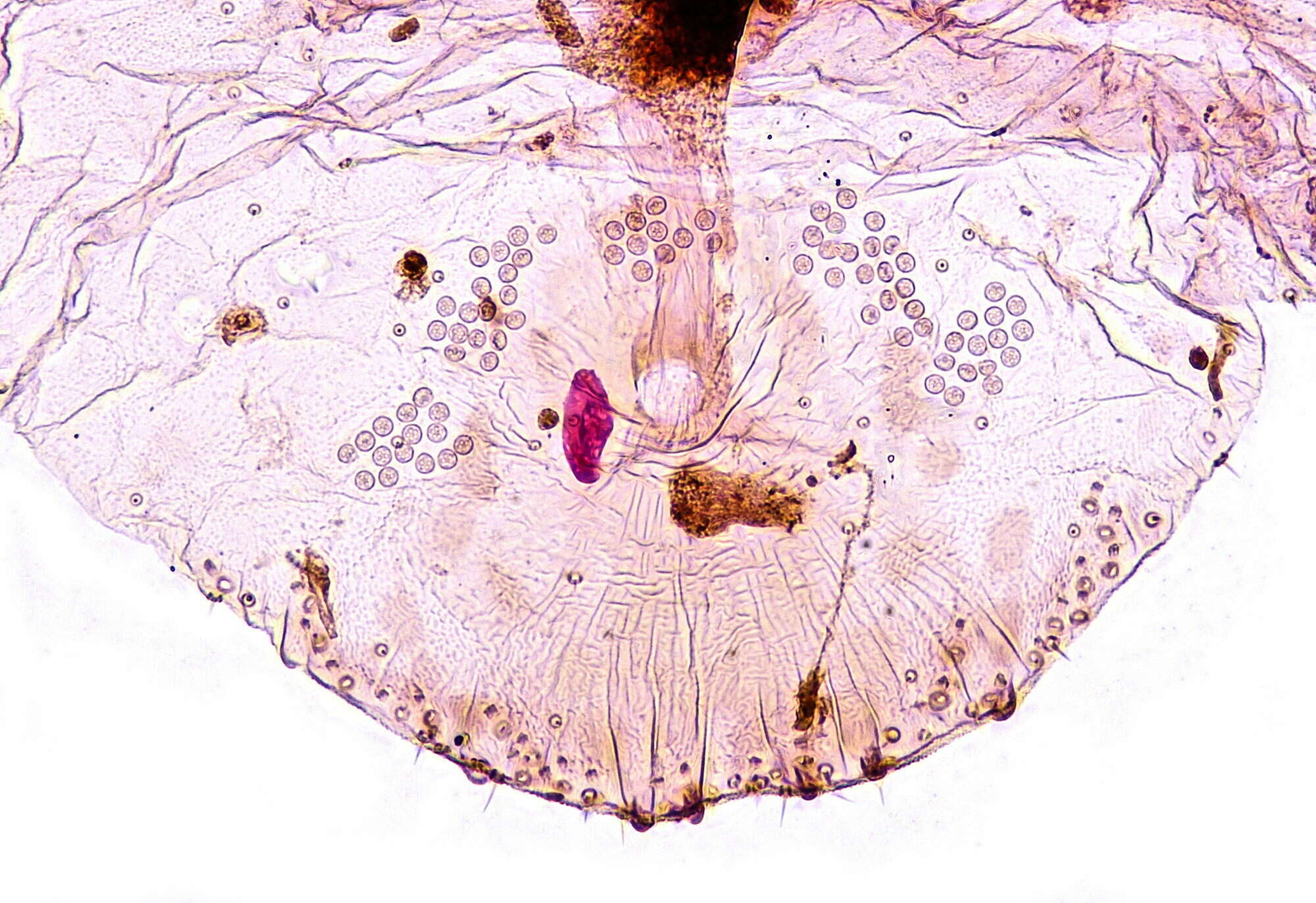 Image of Leucaspis lowi Colvée 1882