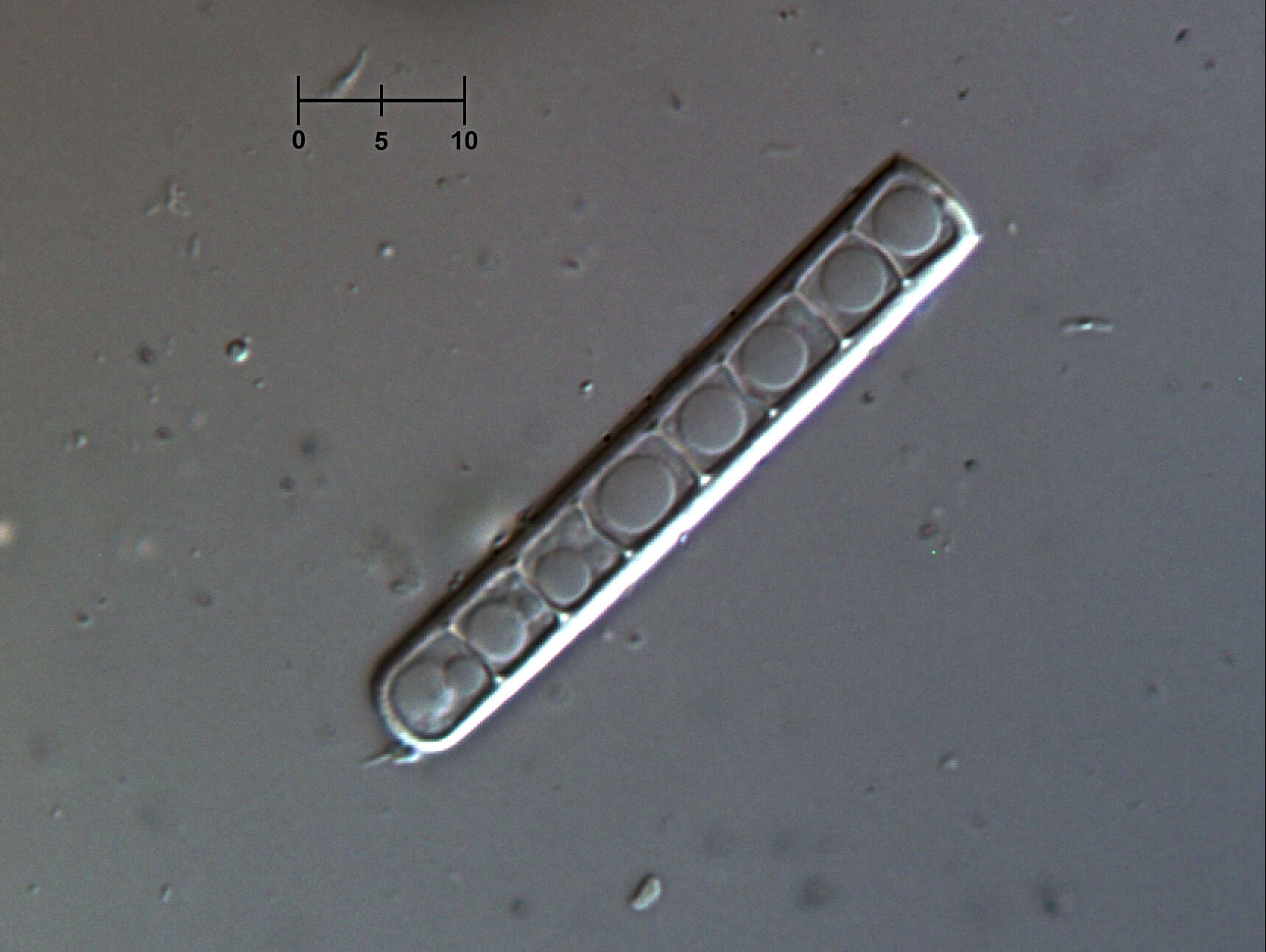 Sivun Chalara insignis (Sacc., M. Rousseau & E. Bommer) S. Hughes 1953 kuva