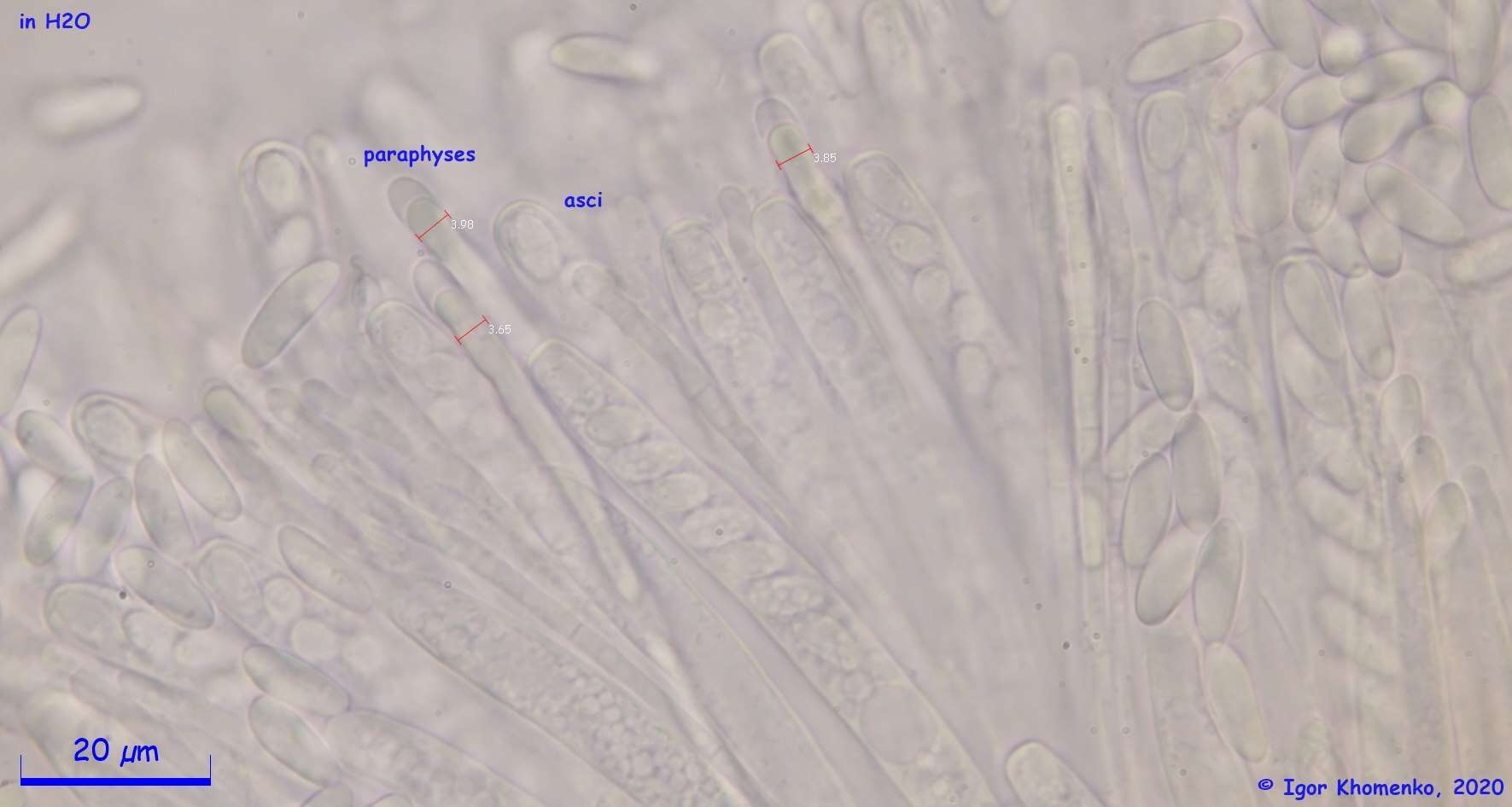 صورة Ciborinia pseudobifrons Whetzel ex J. W. Groves & Bowerman 1955