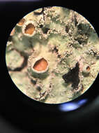 Image of shield lichen