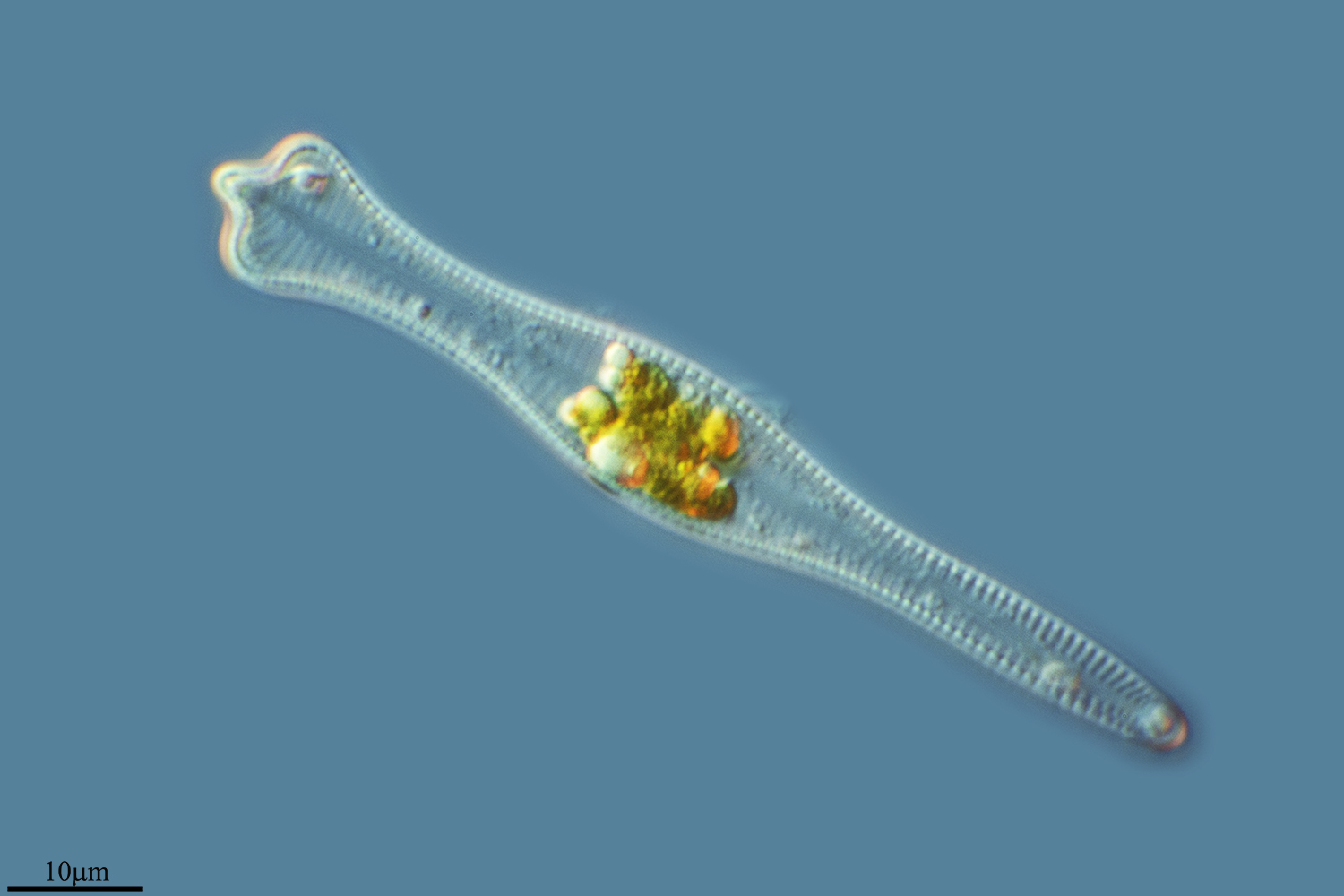Image of <i>Gomphonema acuminatum</i>