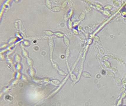 Phialemonium inflatum (Burnside) Dania García, Perdomo, Gené, Cano & Guarro 2013 resmi