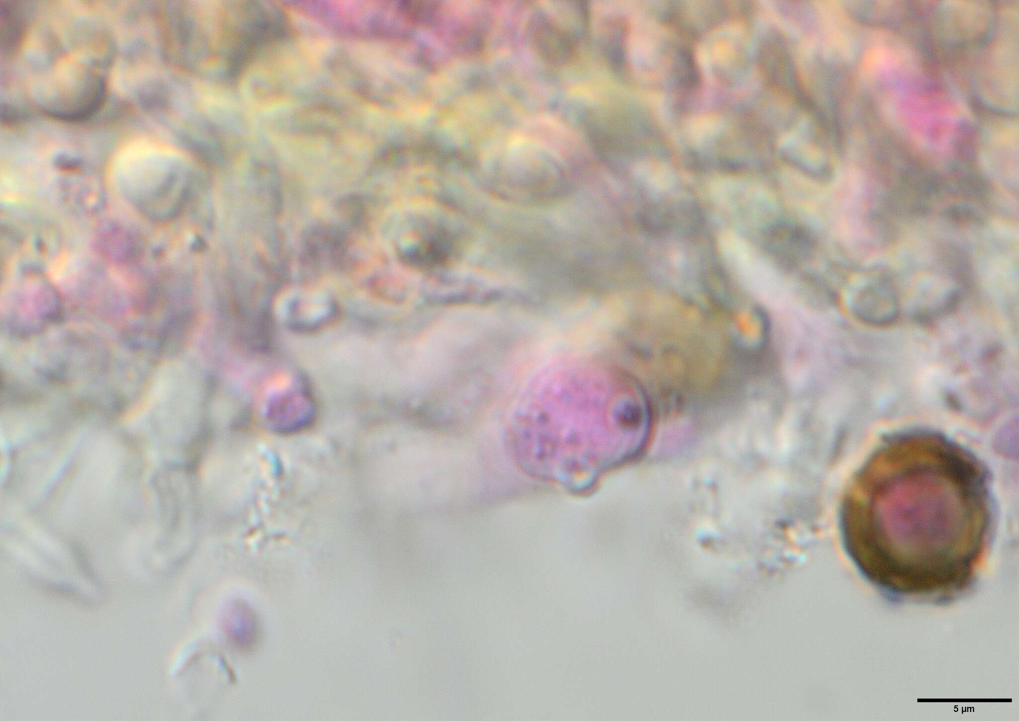 Image of Biatoropsis