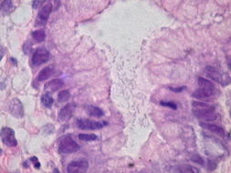 Image of <i>Helicobacter pylori</i>