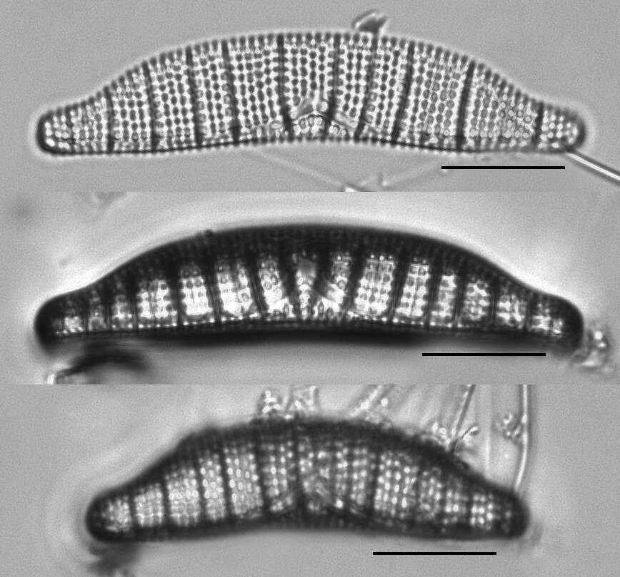 Image of Epithemia adnata (Kützing) Brébisson 1838