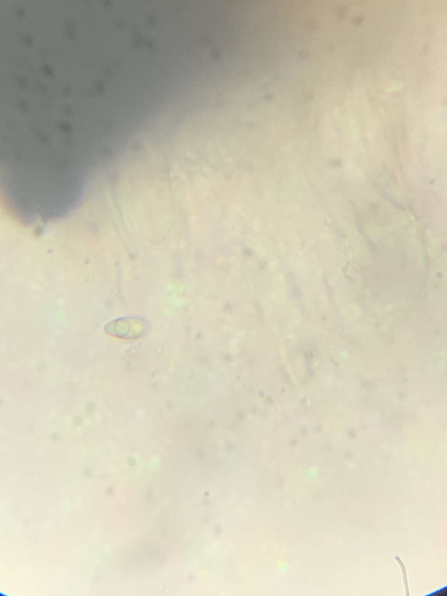 Image de Anisomeridium biforme (Borrer) R. C. Harris