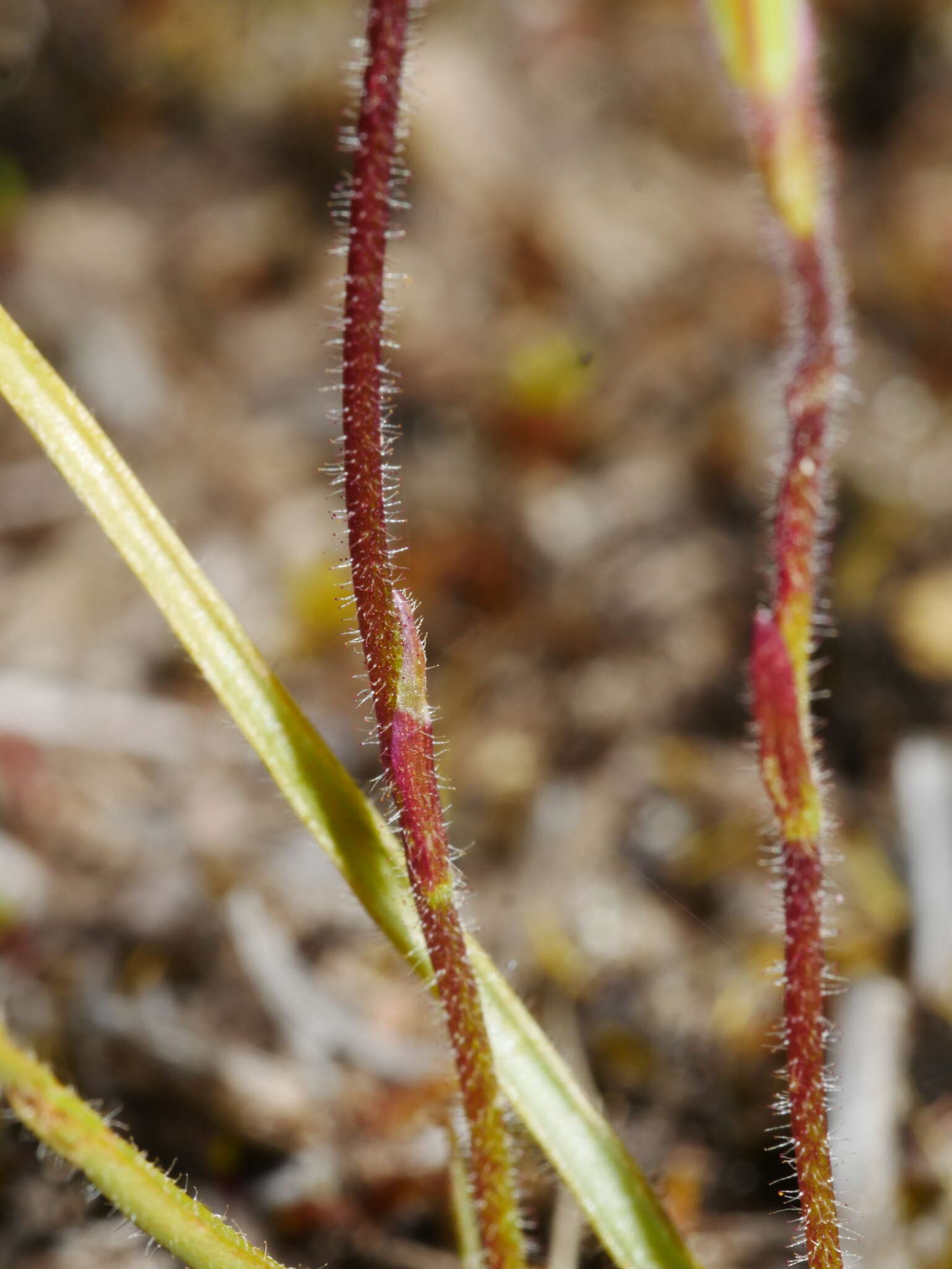 Image of White fingers