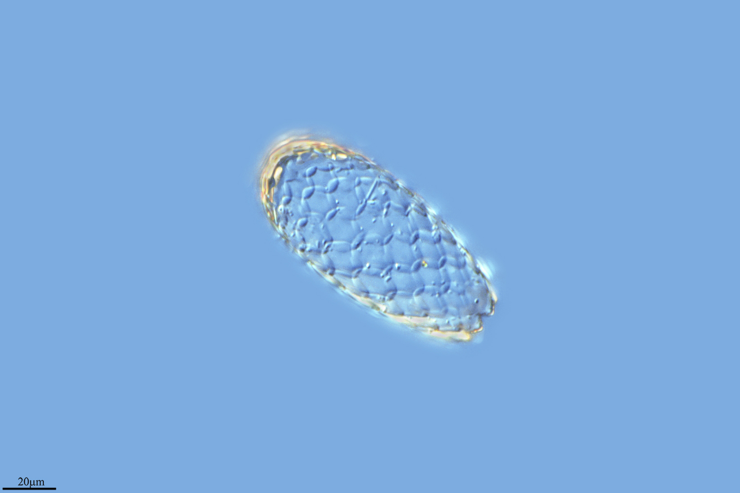 Image of <i>Euglypha tuberculata</i>