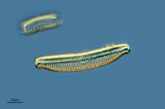 Image of <i>Epithemia turgida</i>