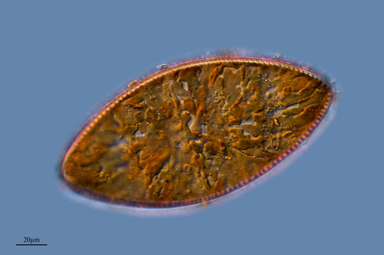 Image of <i>Cymatopleura ellyptica</i>