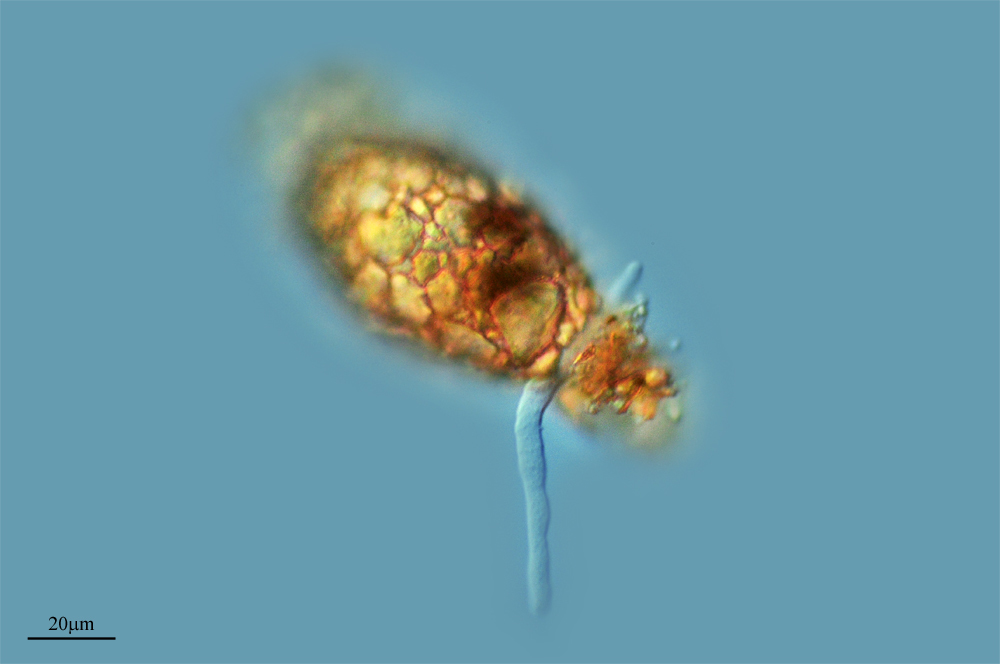 Image of <i>Difflugia pyriformis</i>