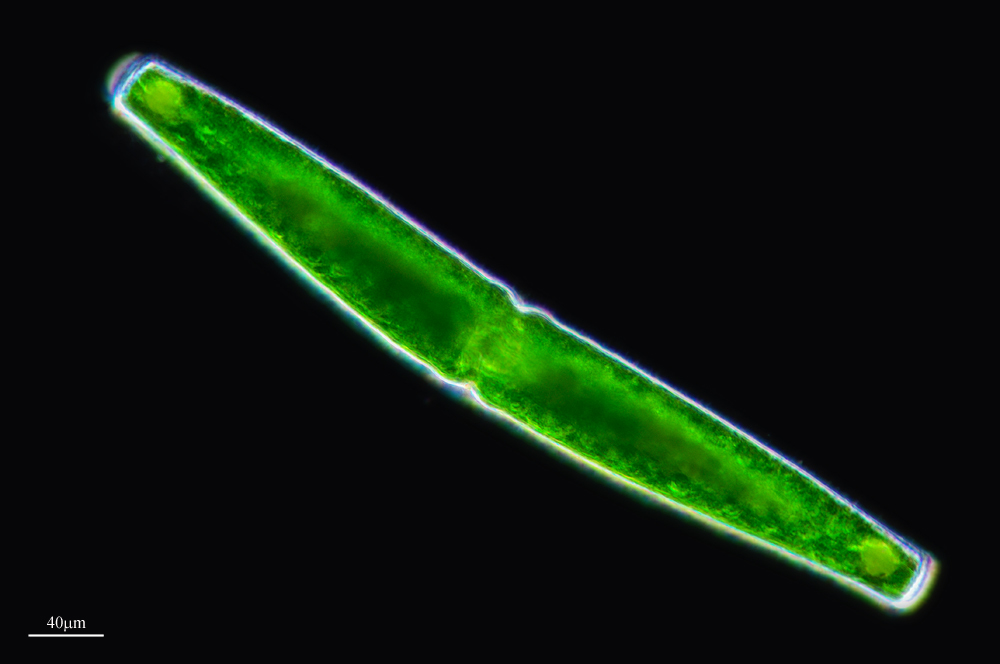 Image of <i>Pleurotaenium trabecula</i>