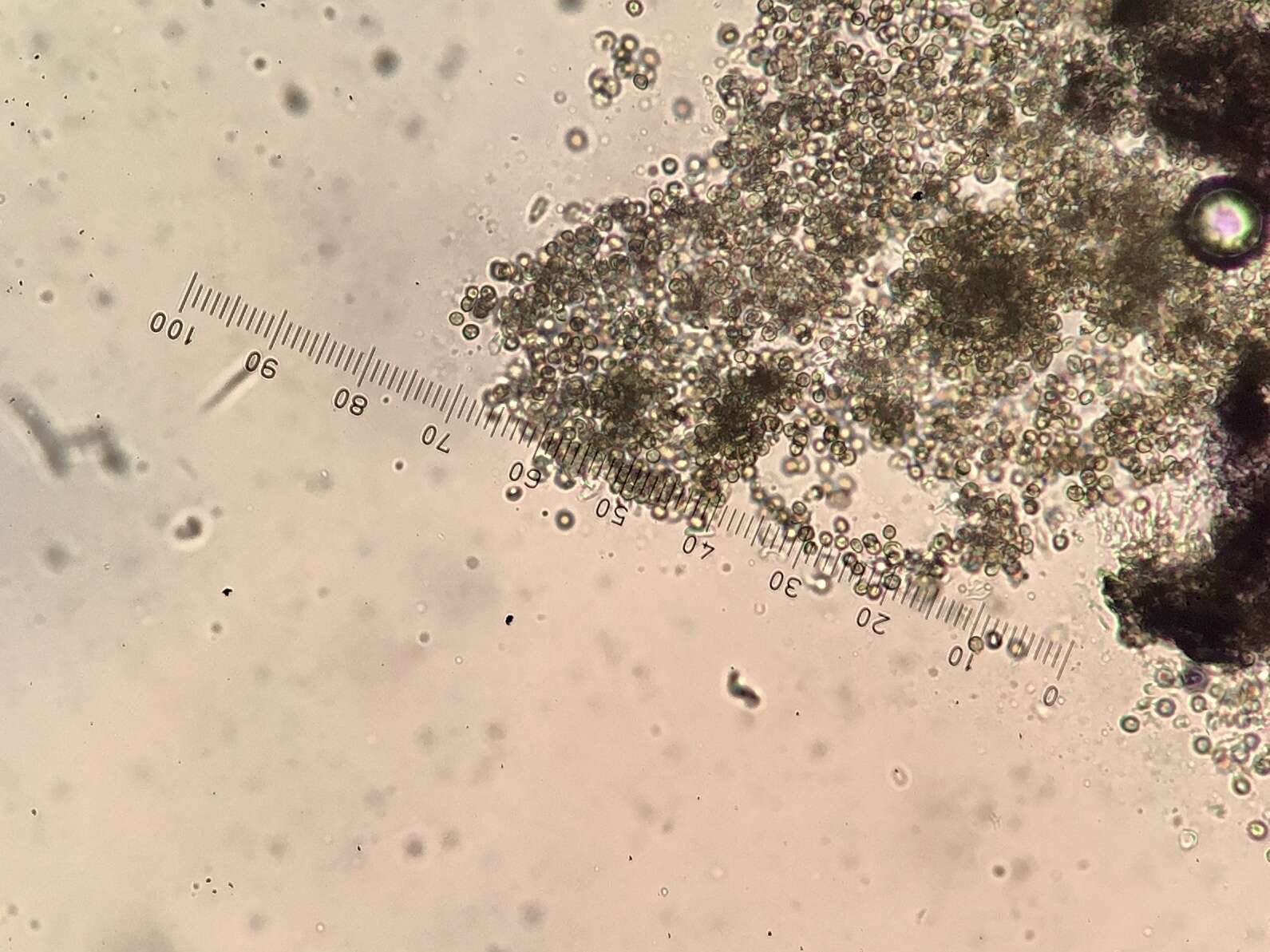 Image of Lichenoconium pyxidatae (Oudem.) Petr. & Syd. 1927