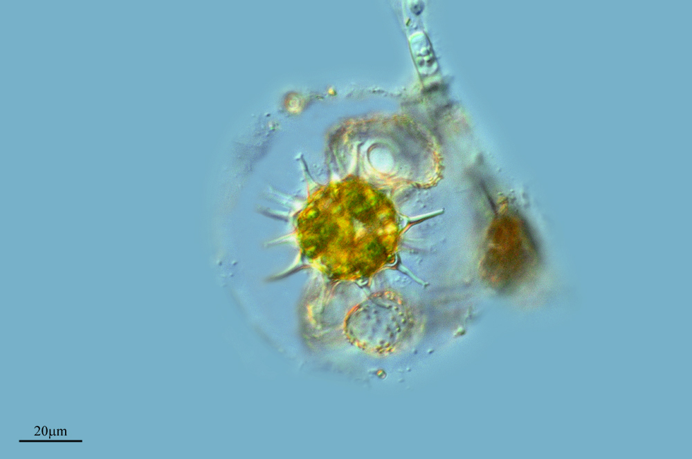 Image of <i>Cosmarium botrytis</i>