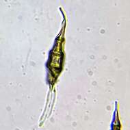 Слика од Pestalotiopsis chamaeropis Maharachch., K. D. Hyde & Crous 2014