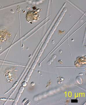 Image of Cylindrospermopsis G. Seenayya & N. Subba Raju 1972