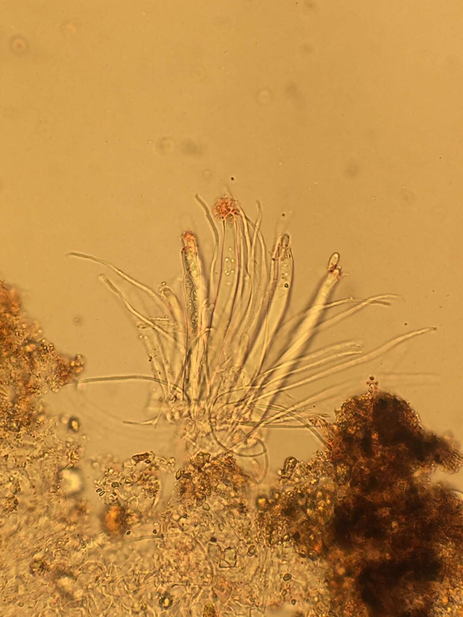 Image de Pezoloma ciliifera (P. Karst.) Korf 1971