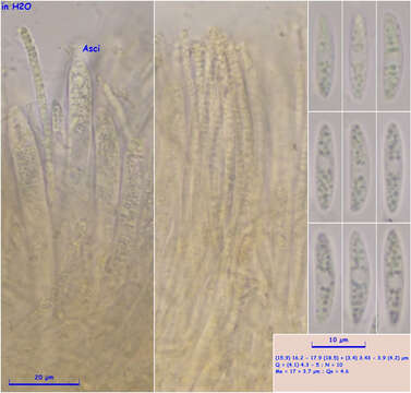 Image de Hymenoscyphus menthae (W. Phillips) Baral 1985