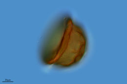 Image of <i>Arcella vulgaris</i>