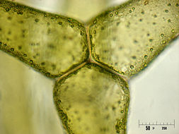 Image of <i>Hydrodictyon reticulatum</i>