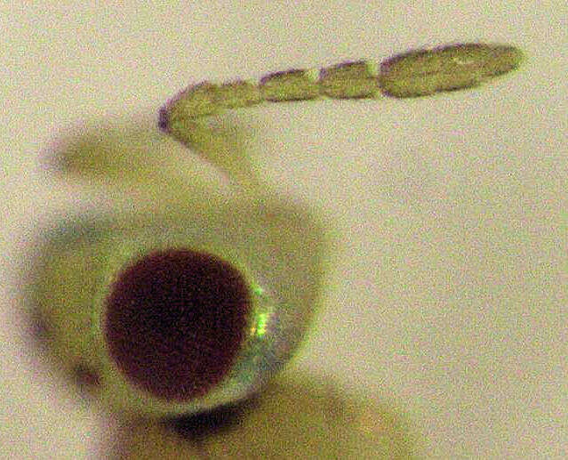 Image of Parasitoid wasp