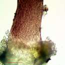 Image of sphinctrina lichen