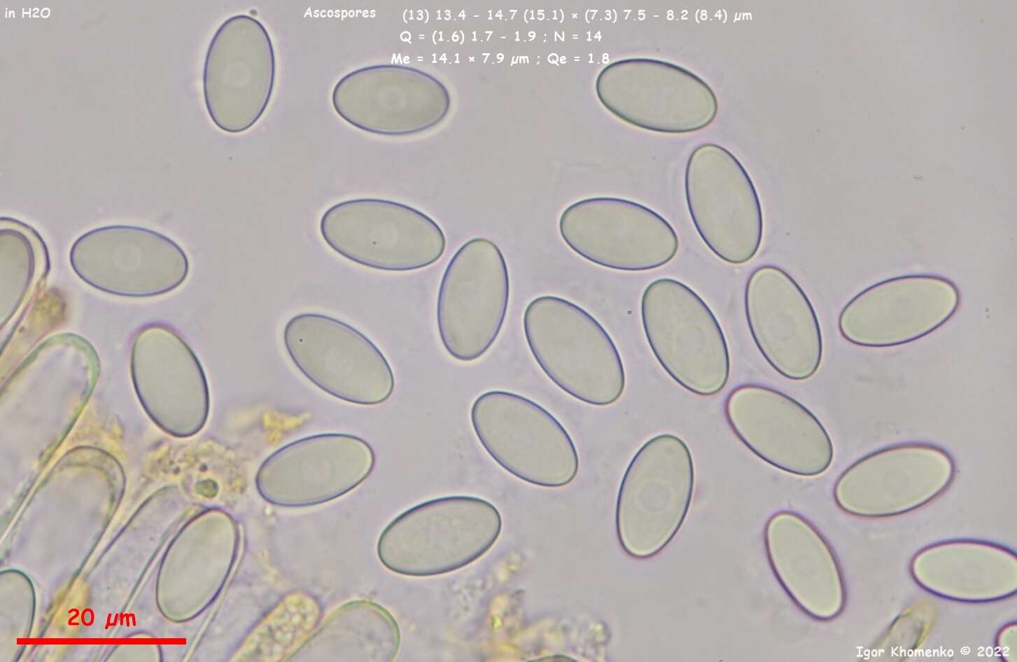 Image of Cheilymenia stercorea (Pers.) Boud. 1907