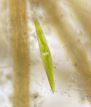 Image of Closterium acerosum f. lanceolatum