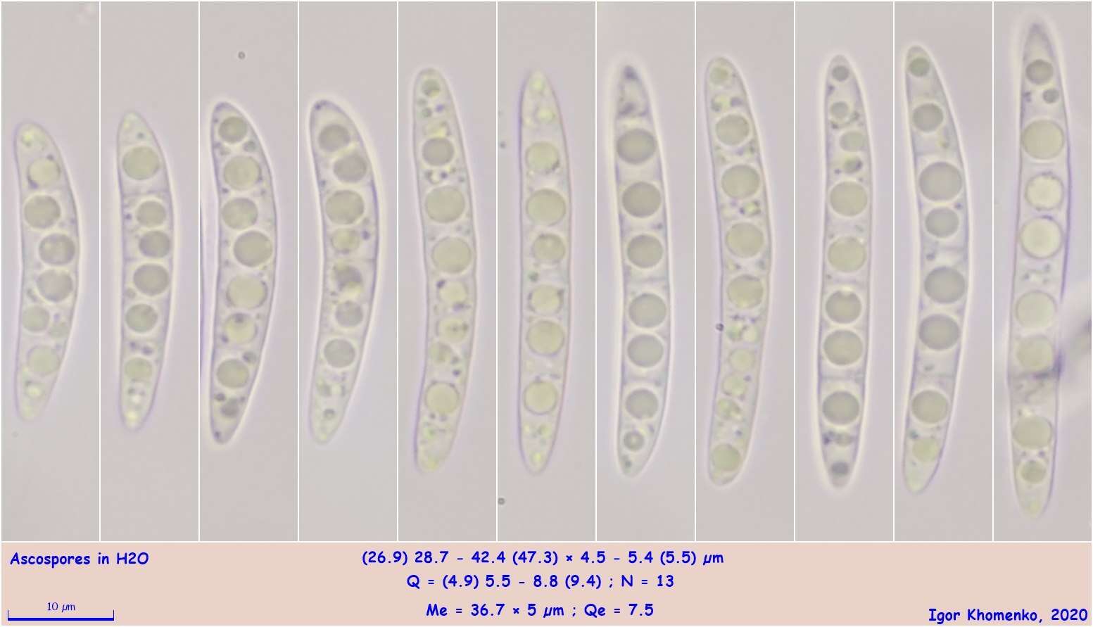 Image of Durella connivens (Fr.) Rehm 1881