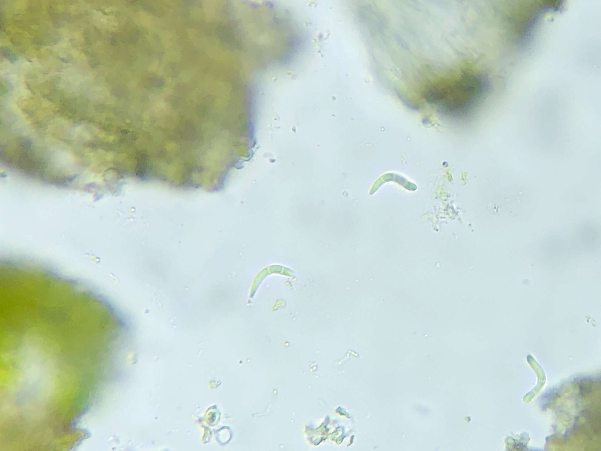 Слика од Scoliciosporum umbrinum (Ach.) Arnold