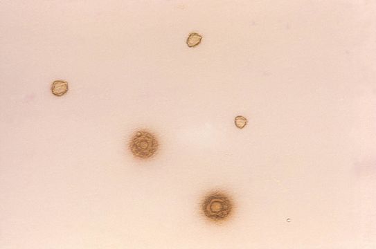 Image of <i>Mycoplasma hominis</i>