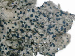 Image of navel lichen