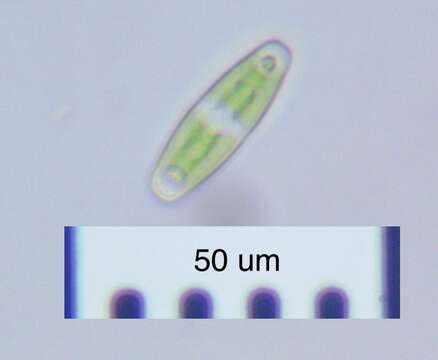 Image of Closterium navicula