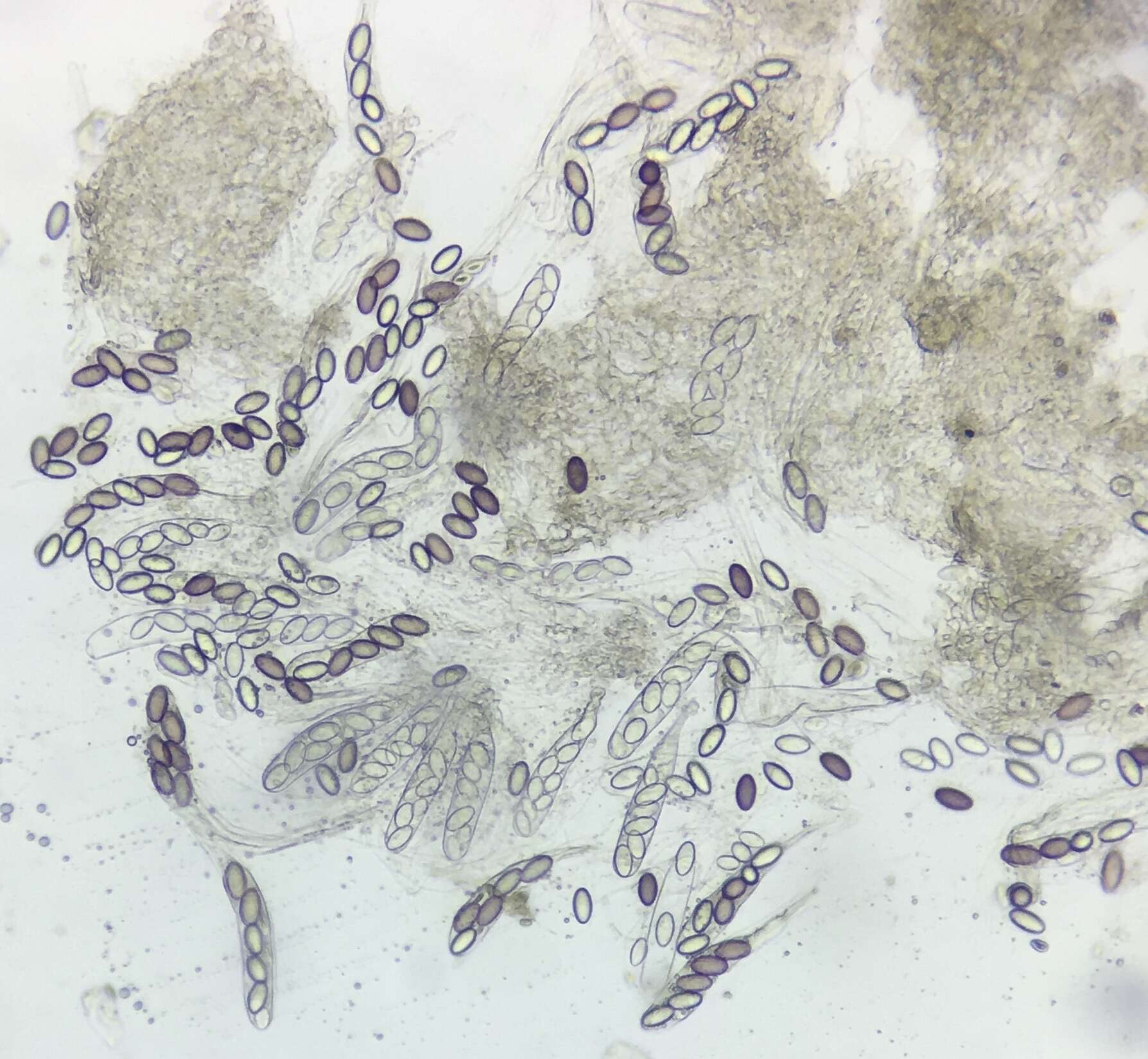 Image de Ascobolus albidus P. Crouan & H. Crouan 1858