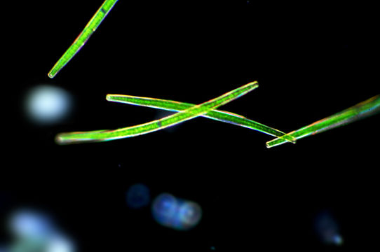 Image of <i>Closterium xxx</i>