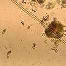 Image of stenocybe lichen