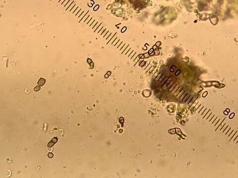 Image of stenocybe lichen