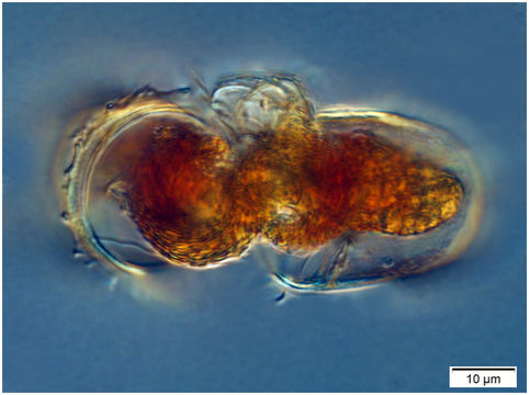 Image of <i>Acanthostomella norvegica</i> (Daday 1887)