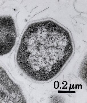 Image of <i>Aeropyrum pernix</i>