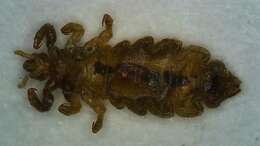 Image of head louse