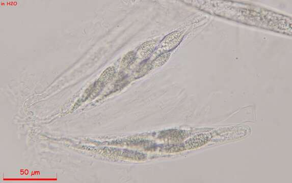 Image of Podospora appendiculata (Auersw. ex Niessl) Niessl 1883