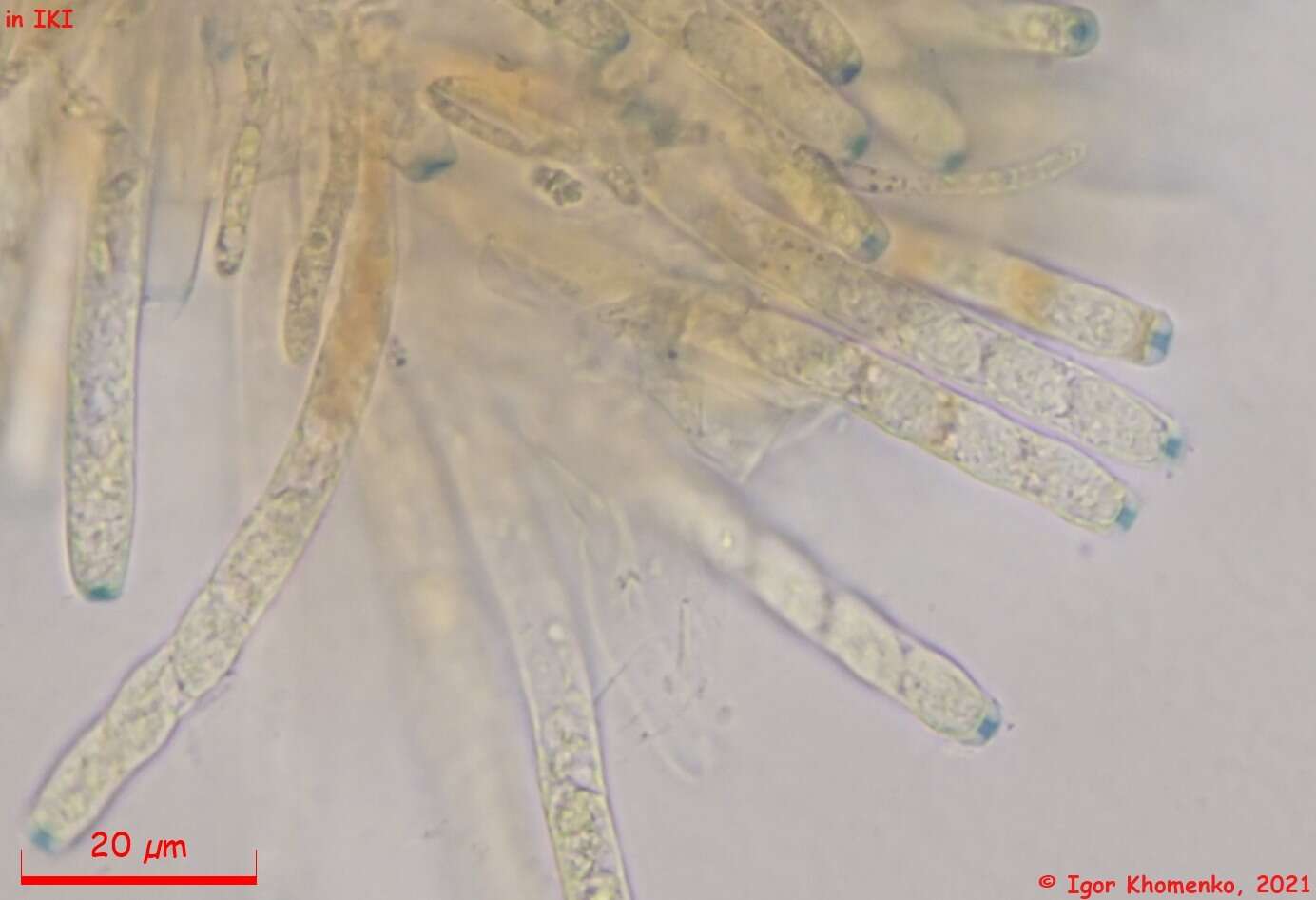 Image of Moellerodiscus capillipes (Quél.) M. P. Sharma 1986