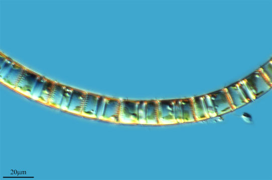 Image of <i>Aulacoseira granulata</i>