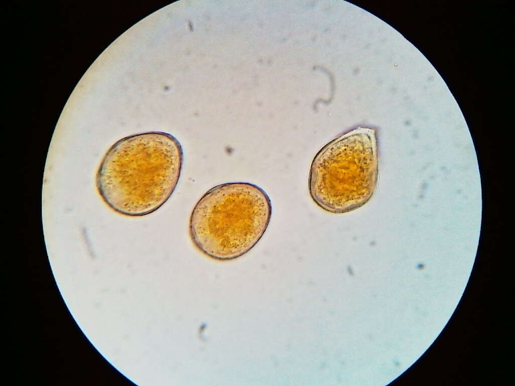 Image de Puccinia asparagi DC. 1805