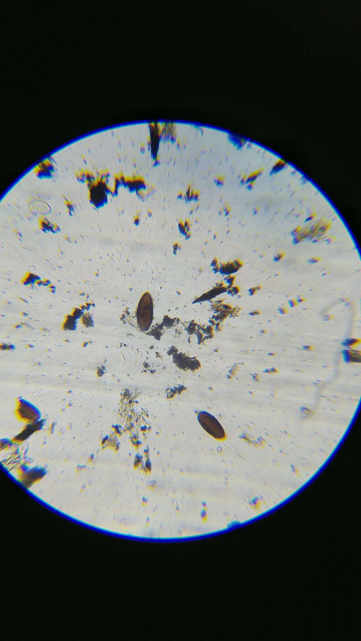 Image of Phaeochoropsis neowashingtoniae (Shear) K. D. Hyde & P. F. Cannon 1999