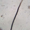 Image of Septosporium bulbotrichum Corda 1837