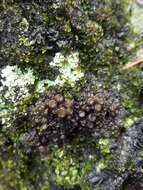 Image of skin lichen