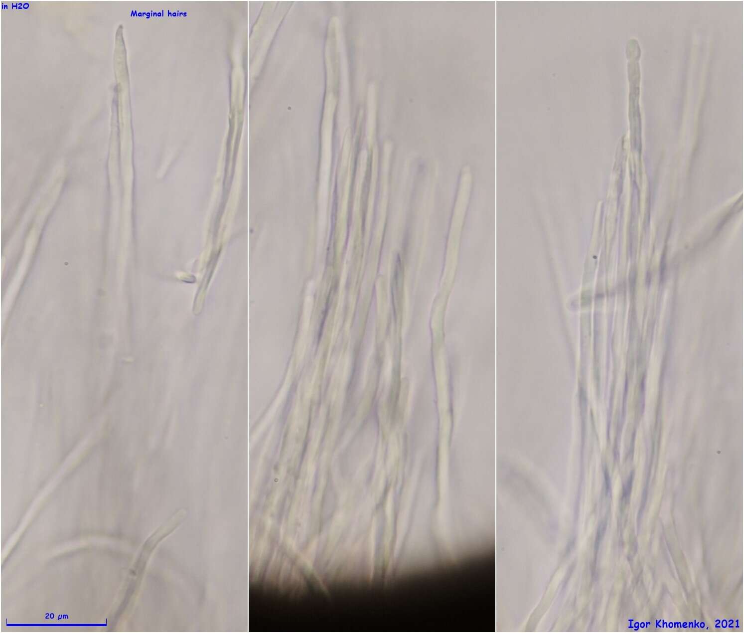 Image of Parachnopeziza miniopsis (Ellis) Korf 1978