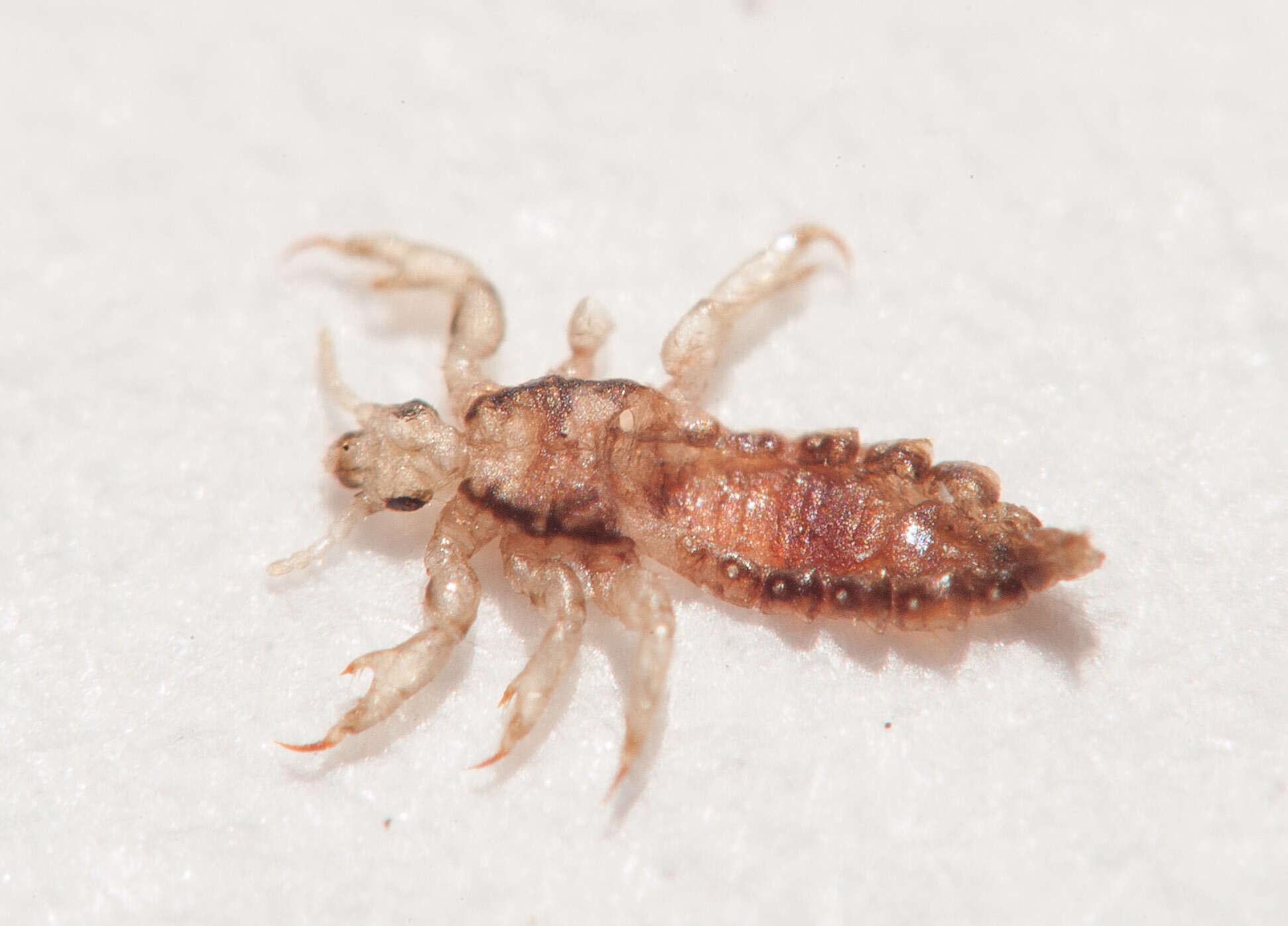 Image of head louse